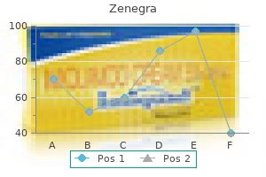 purchase zenegra 100 mg with amex