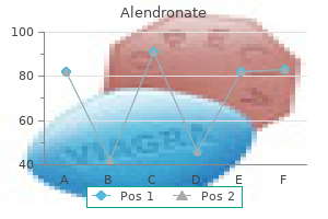 purchase online alendronate