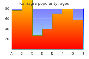 cheap kamagra 50mg