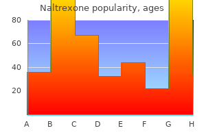 buy line naltrexone