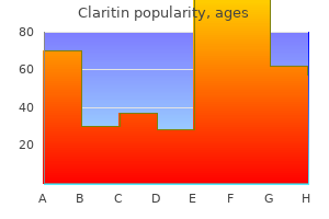 purchase claritin 10mg with visa